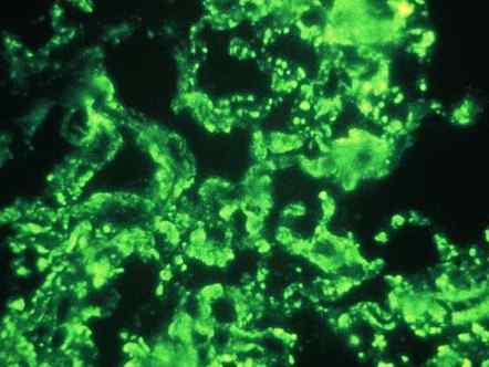 On this image taken with Microscopes you can see a sample that has not been treated, because it is fluorescent by itself. 