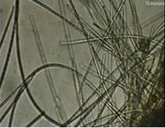 Picture of bacterian cells of marine sediments taken with electron Microscopes.