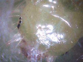 A caterpillar head as seen under the PCE-MM 140 microscope.